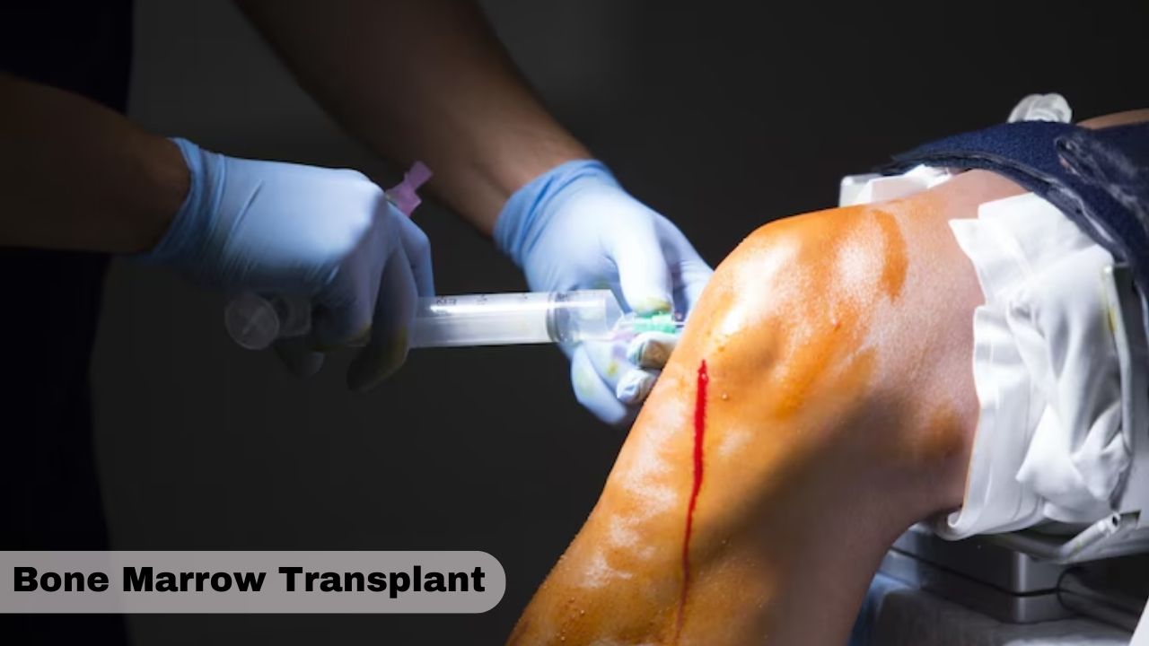 Bone Marrow Transplant in India