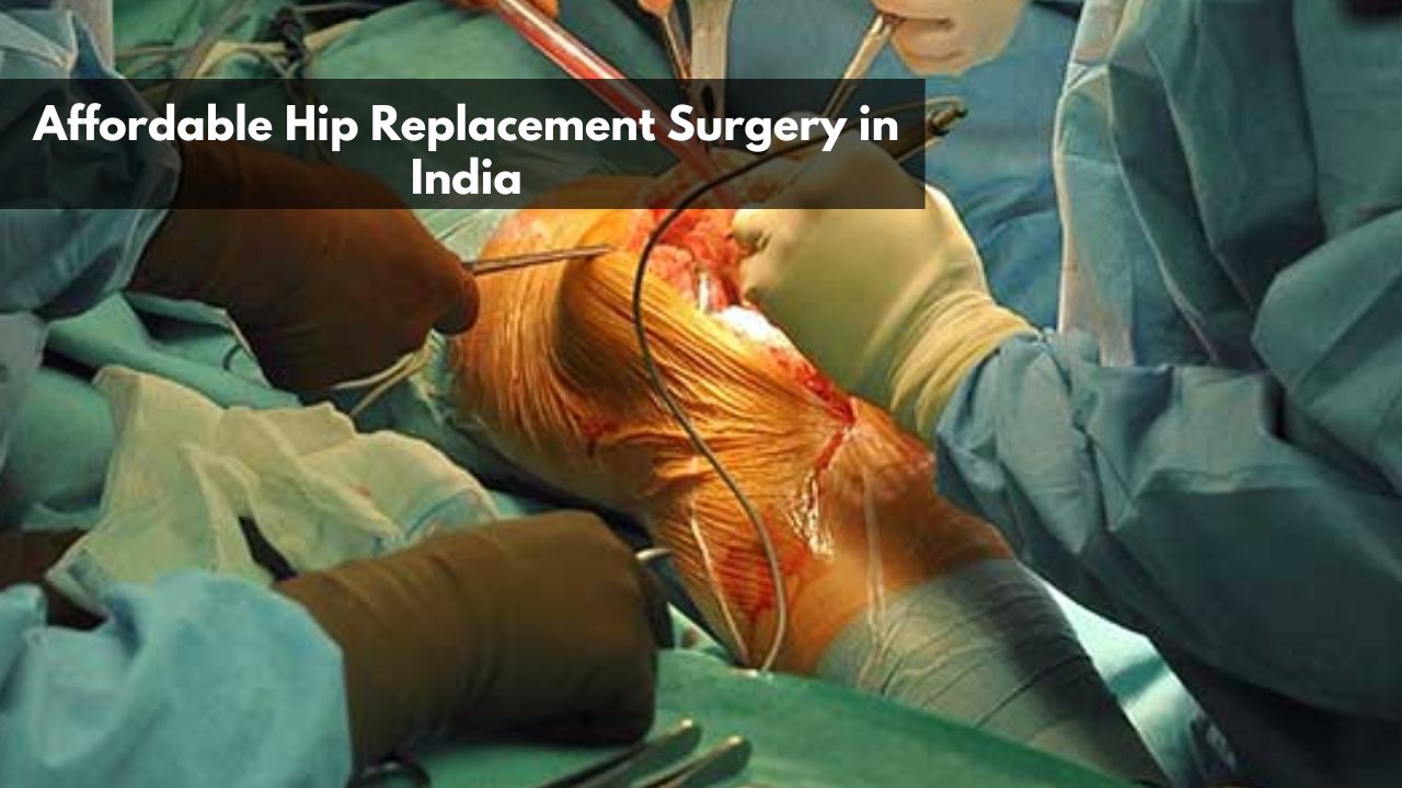 Affordable Hip Replacement Surgery in India