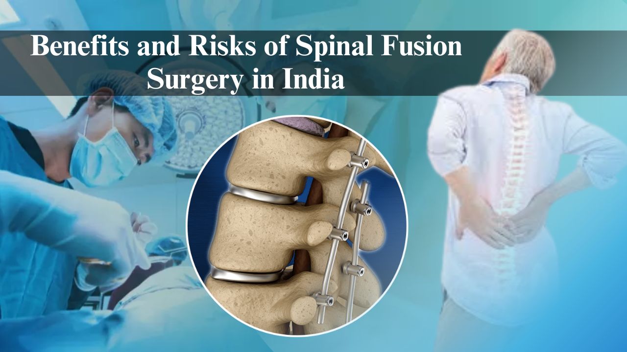 Benefits and Risks of Spinal Fusion Surgery in India