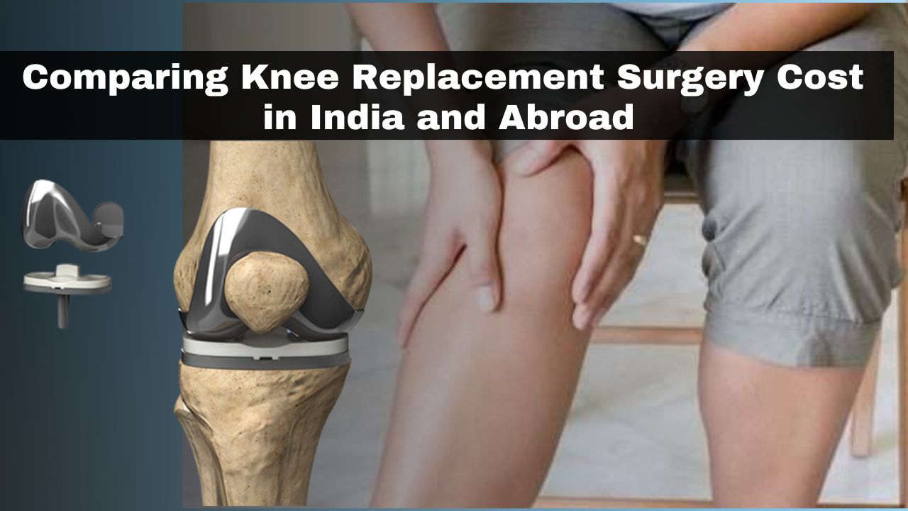 Comparing Knee Replacement Surgery Costs in India and Abroad