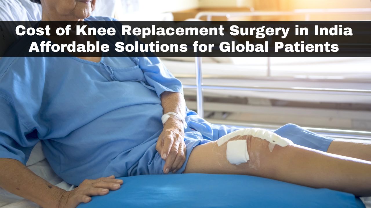Cost of Knee Replacement Surgery in India Affordable Solutions for Global Patients