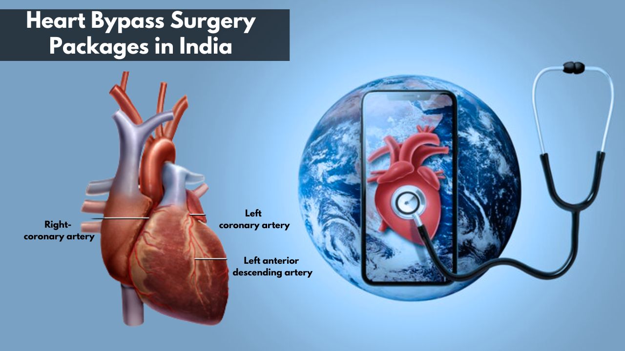 Heart Bypass Surgery Packages in India