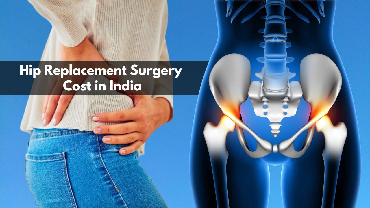 Hip Replacement Surgery Cost in India