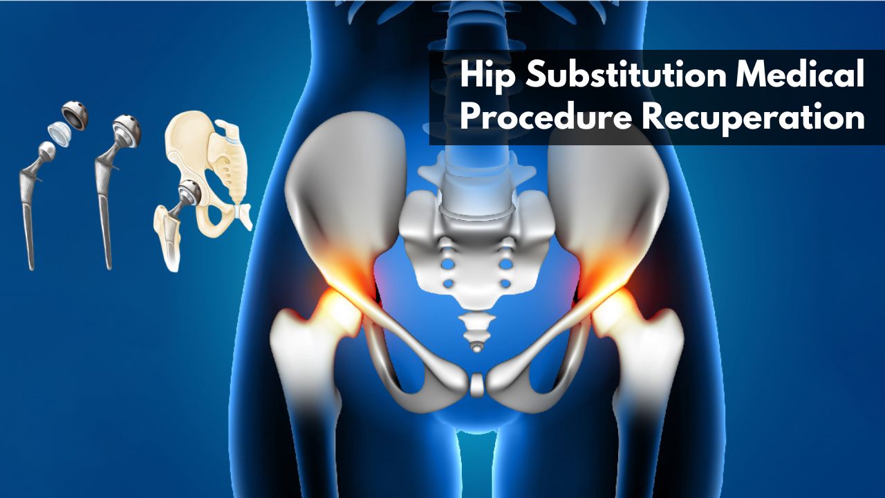 Hip Substitution Medical Procedure Recuperation