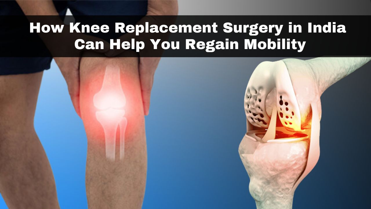 How Knee Replacement Surgery in India Can Help You Regain Mobility