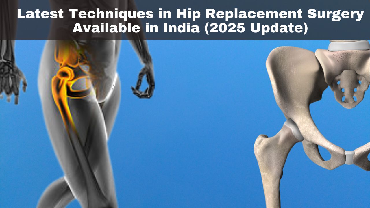 Latest Techniques in Hip Replacement Surgery Available in India (2025 Update)