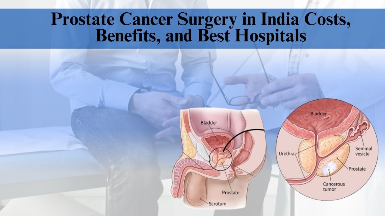 Prostate Cancer Surgery in India Costs, Benefits, and Best Hospitals