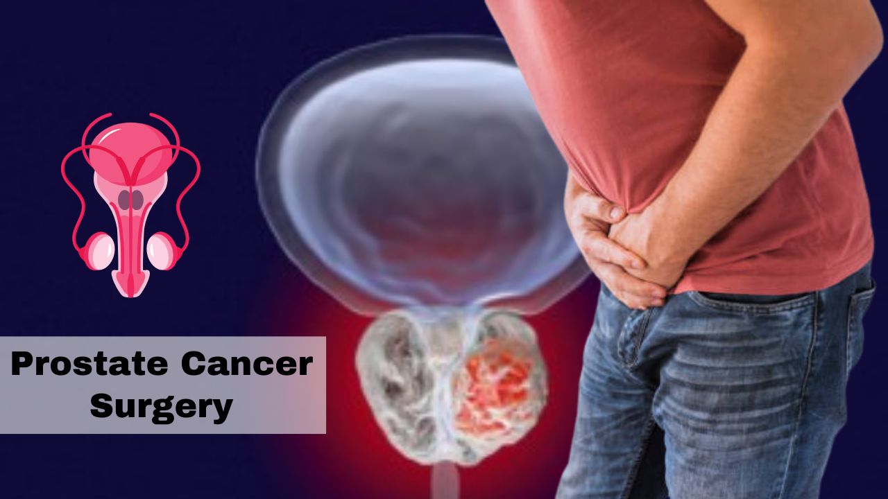 Prostate Cancer Surgery Hospitals in India