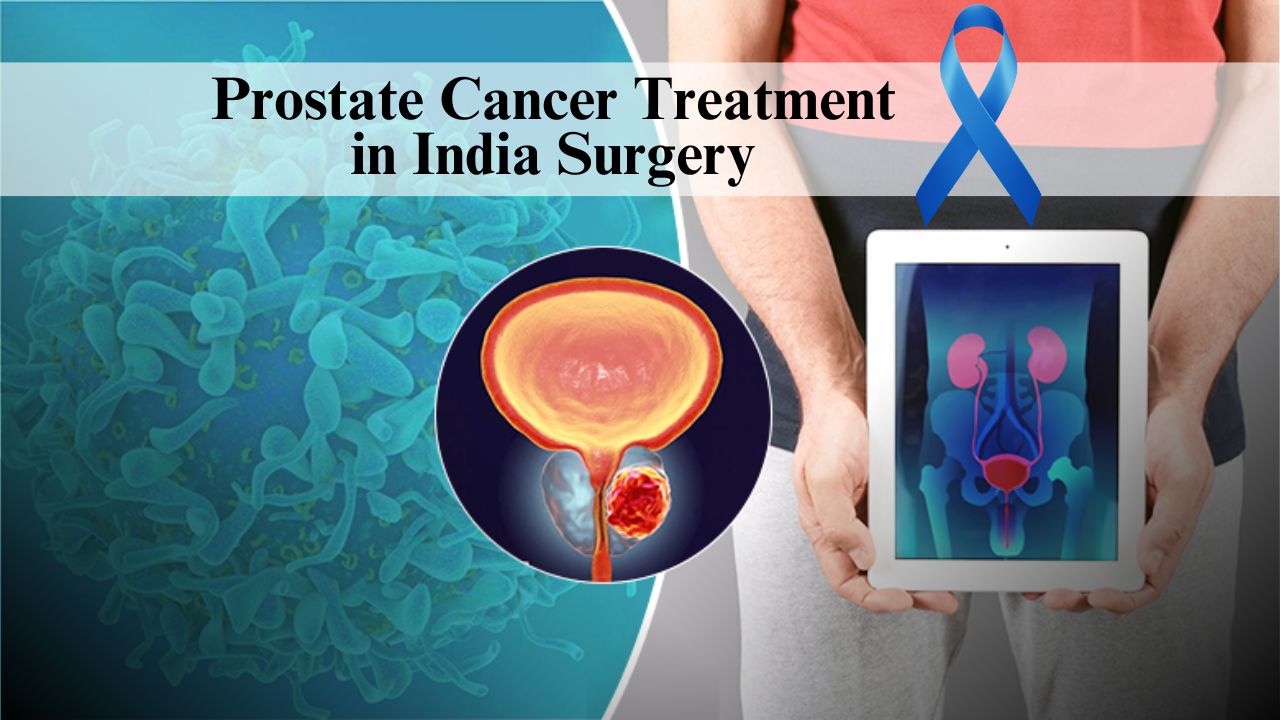 Prostate Cancer Treatment in India Surgery