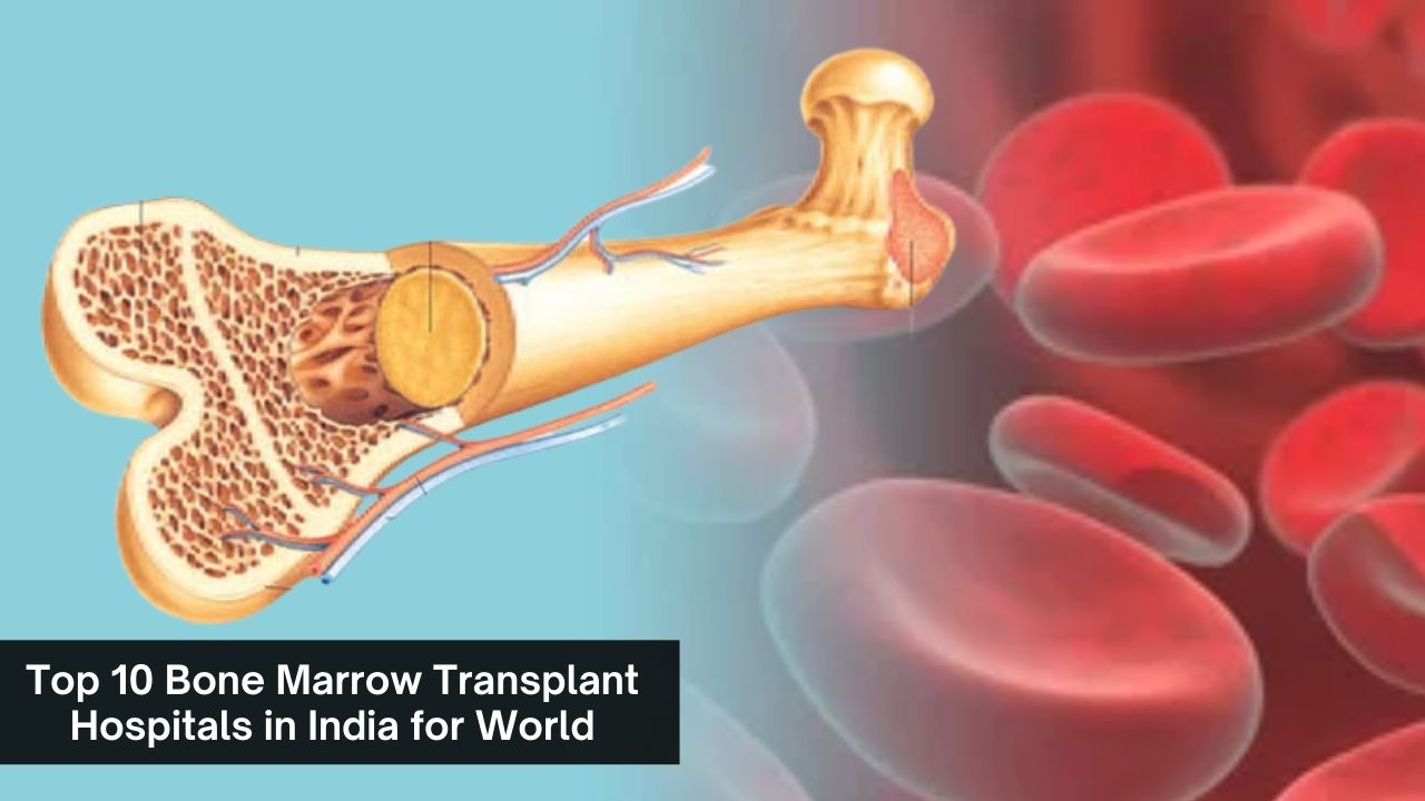 Top 10 Bone Marrow Transplant Hospitals in India for World-Class Treatment