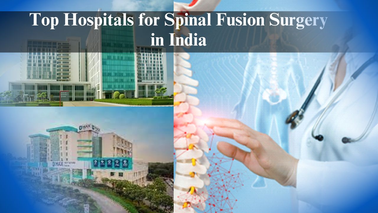 Top Hospitals for Spinal Fusion Surgery in India