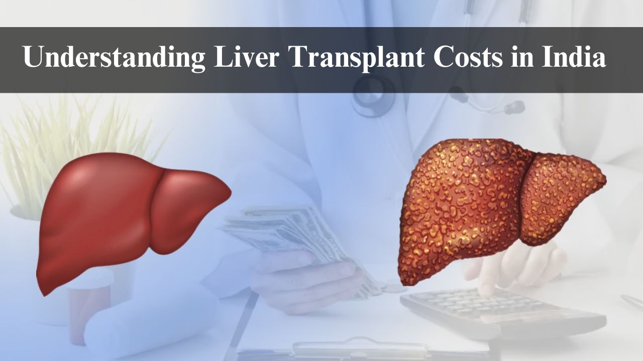 Understanding Liver Transplant Costs in IndiaLiver transfers are life-saving systems for patients experiencing end-stage liver illness or intense liver disappointment. In India, the cost of a liver transplant can vary widely, making it crucial for patients and families to understand the financial implications involved. This guide aims to provide a detailed breakdown of liver transplant costs in India and practical tips to help manage expenses effectively.