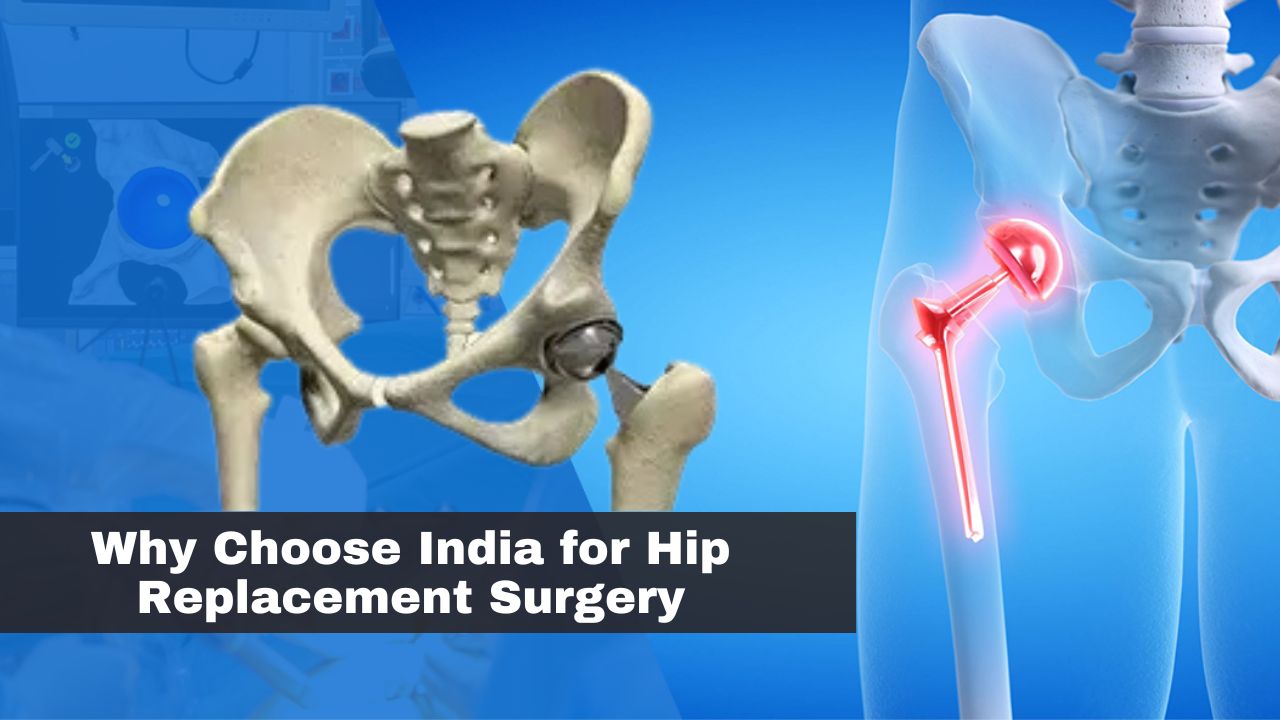 Why Choose India for Hip Replacement