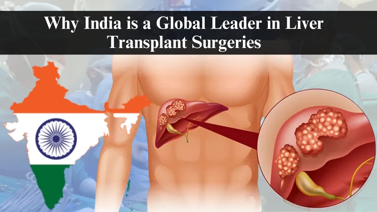Why India is a Global Leader in Liver Transplant Surgeries